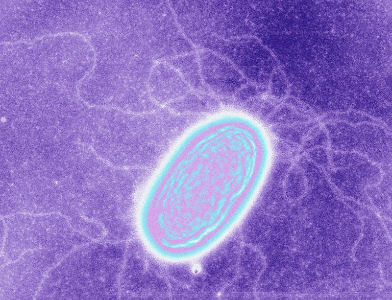 Geobacter – a current favourite (Image: Derek Lovley/SPL)