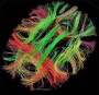 Monotreme and marsupial brain hemispheres communicated before development of corpus callosum | Bob Yirka
