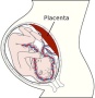 Genes, environment and schizophrenia -- new study finds the placenta is the missing link | Daniel R. Weinberger