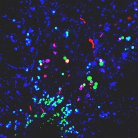 Nanoplastics Promote Conditions For Parkinson's -- Duke University Medical Center
