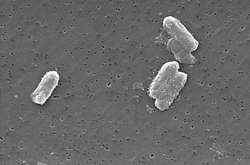 Enterobacteriaceae. Citrobacter freundii, one member of the family. Credit: Public Domain