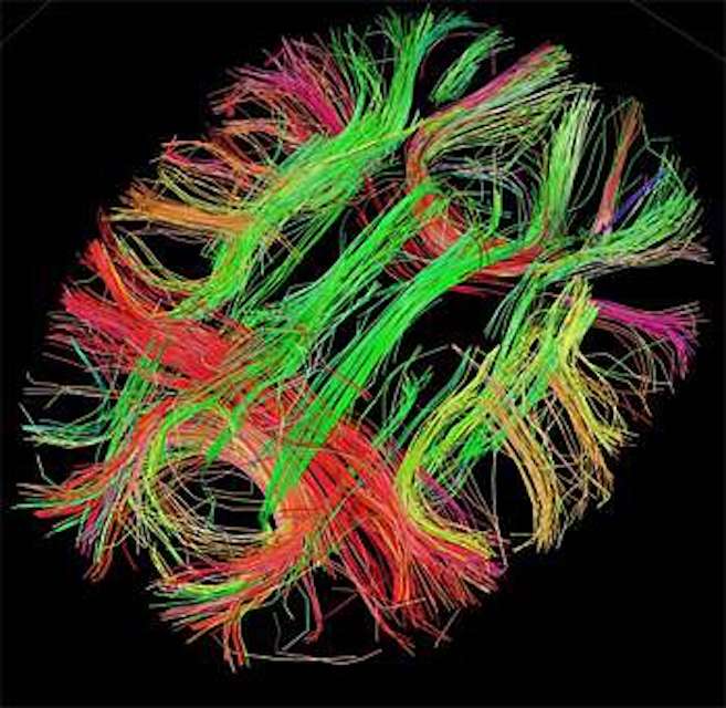 White matter fiber architecture of the brain. Credit: Human Connectome Project.