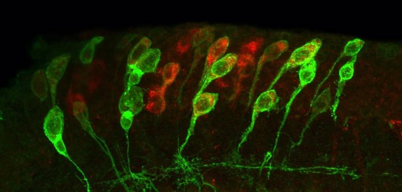 Small (dormant) and enlarged (reactivated) neural stem cells expressing membrane-tagged GFP (green) and the cell cycle marker Cyclin B (red) in the young Drosophila fruit fly larval brain. Credit: University of Plymouth