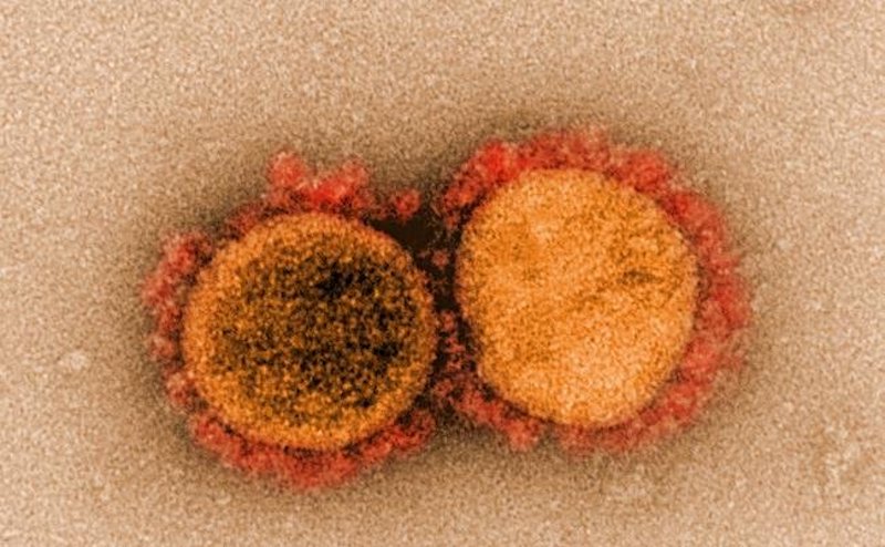 Transmission electron micrograph of SARS-CoV-2 virus particles, isolated from a patient. Image captured and color-enhanced at the NIAID Integrated Research Facility in Fort Detrick, Maryland. Credit: NIAIDTransmission electron micrograph of SARS-CoV-2 virus particles, isolated from a patient. Image captured and color-enhanced at the NIAID Integrated Research Facility in Fort Detrick, Maryland. Credit: NIAID