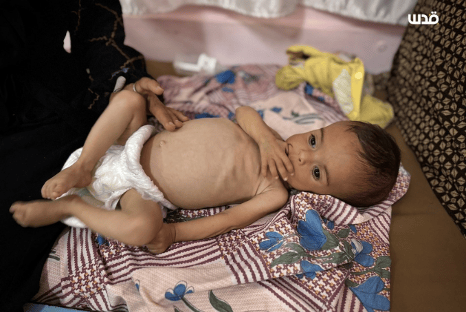   Israel has continued to use starvation of civilians as a weapon of war against Palestinians in Gaza.(Photo: via QNN)